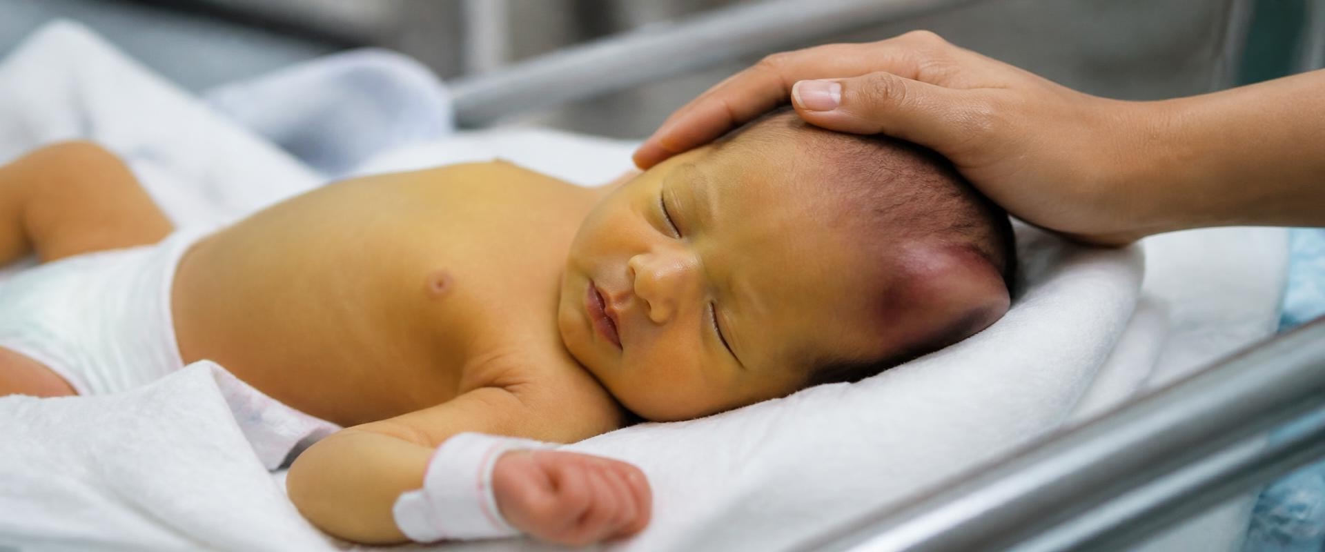 Cephalohematoma and Newborn Jaundice: How Head Bleeding Raises Bilirubin Levels and When Kernicterus Becomes a Concern