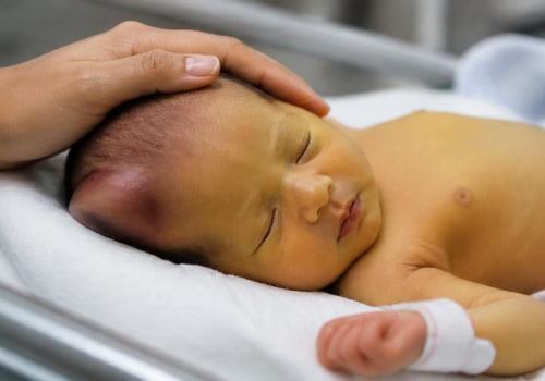 Cephalohematoma and Newborn Jaundice: How Head Bleeding Raises Bilirubin Levels and When Kernicterus Becomes a Concern